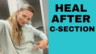 4 Ways to Heal after CSection The First 68 Weeks  CSection Recovery Tips [upl. by Prisca]