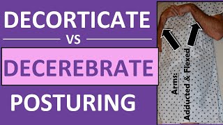 Decerebrate vs Decorticate Posturing Rigidity Mnemonic amp Pictures Nursing NCLEX [upl. by Eerol]