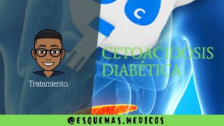 CETOACIDOSIS DIABÉTICA  TRATAMIENTO [upl. by Eitra863]