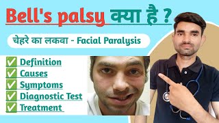 Bells palsy in Hindi  Causes Symptoms And Treatment of Bells palsy  Facial Paralysis in Hindi [upl. by Marcile349]