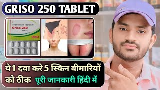 Griso 250 tablet uses dose benefits and Side effects full review in hindi [upl. by Theobald6]