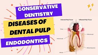 ADC part 1 exam  A simple way to diagnose pulpal diseases [upl. by Latrice]