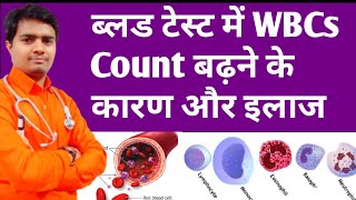 High Wbcs Count In Blood  ब्लड में WBCs बढ़ने के कारण और इलाज  High Wbc Count Treatment In Hindi [upl. by Gamal]