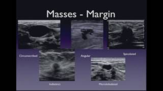 Ultrasound Imaging of the Breast – Lesion Characterization [upl. by Clem]