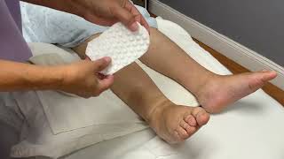 Application of Mobiderm Pad during the intensive phase of treatment [upl. by Leila]