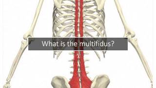 Multifidus Back Pain Why Your Doctor Never Discussed It [upl. by Ahsikit]