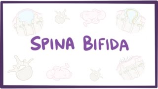 Spina bifida myelomeningocele meningocele occulta  causes symptoms treatment [upl. by Khano]