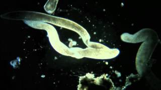 Spirostomum la conjugaison [upl. by Edee56]