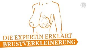 Brustverkleinerung Brustreduktion  Dr Simone Hellmann erklärt  HPraxis Köln [upl. by Nauqel]