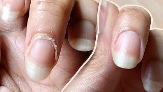 NAIL TRANSFORMATION  how I CUT CUTICLES at HOME  Basic Tools ONLY [upl. by Berg]