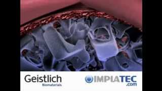 Guided Bone Regeneration with Geistlich Biomaterials [upl. by Akeryt]