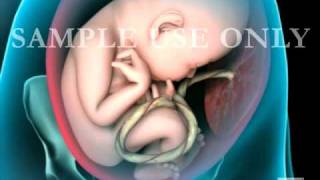 Breech Birth Position  3D Rotation [upl. by Iridis]