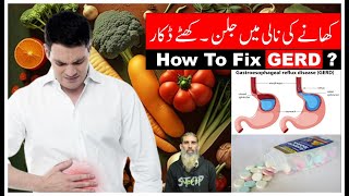 How to Fix Gastroesophageal Reflux Disease GERD  By Dr Ishtiaq [upl. by Uyerta]