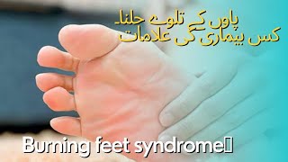 Burning feet syndrome پاوں کے تلوے جلنا۔ کس بیماری کی علامات [upl. by Horwath]