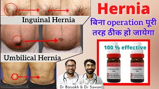 Hernia Homeopathic medicine for hernia explian [upl. by Russel]