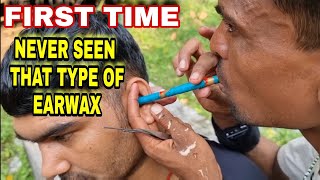 Indian BarberUnbelievable Earwax Ear Cleaning By Different Tools Must Watch [upl. by Etta]