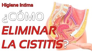 ¿Por qué se produce la cistitis Formas de eliminar la infección [upl. by Anirad]