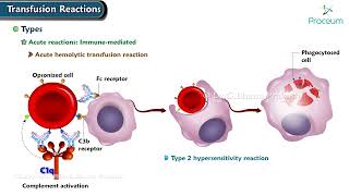 Transfusion Reactions  Hematology [upl. by Iliram]