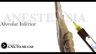 Anestesia do Nervo Alveolar Inferior anatomia [upl. by Aseral450]