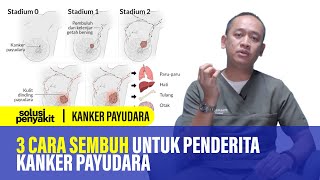 Kanker Payudara Gejala Penyebab dan Penanganannya  Kata Dokter 158 [upl. by Ocnarf]