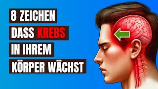 Vernachlässigen Sie Nicht Diese 8 Frühen Anzeichen von Krebs  Sie könnten Ihr Leben retten [upl. by Banky130]