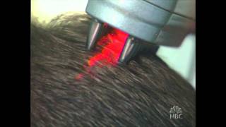 HairMax LaserComb tested on Dateline NBC  The Follicle 5  Part 5 [upl. by Abshier]