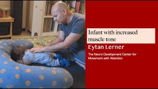 Infant with hypertonic muscle  Lesson by Eytan Lerner [upl. by Yadrahc]