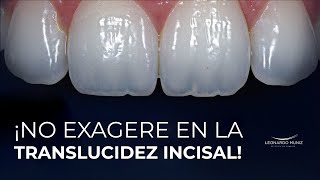 ¡No exagere en la translucidez incisal [upl. by Lissie]