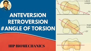 Anterversionamp Retroversion Angle of torsionhip biomechanics [upl. by Sherwin]