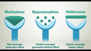 How Opioid Treatment Medications Work On Your Brain  San Diego UnionTribune [upl. by Ymarej]