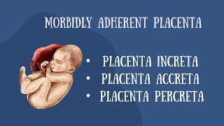 MORBIDLY ATTACHED PLACENTAPLACENTA INRCETAPLACENTA PERCRETAACCRETA [upl. by Salchunas836]