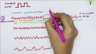 Electroencephalogram EEG  Waves  Physiology [upl. by Weibel]