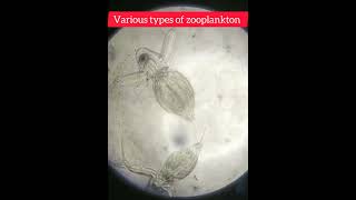 Various types of zooplankton [upl. by Candis380]