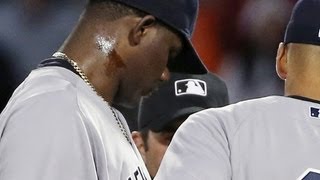 ExMLB pitcher Pineda broke unwritten code with pine tar use [upl. by Solange843]