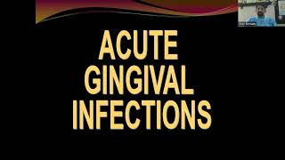 ACUTE GINGIVAL INFECTIONS  DR RISHI EMMATTY DEPT OF PERIODONTICS ROYAL DENTAL COLLEGE [upl. by Docila]