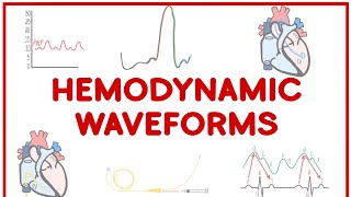 Hemodynamic Waveforms Made Simple [upl. by Malkah]