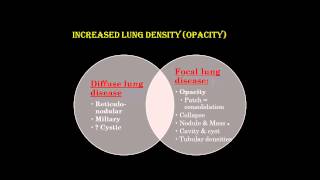 Chest X ray interpretation Part1DR AMR SAADAWY [upl. by Solita]