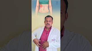 gallbladder stone symptoms  gallbladder stones symptoms  gallbladder stone symptoms tamil [upl. by Anomar455]