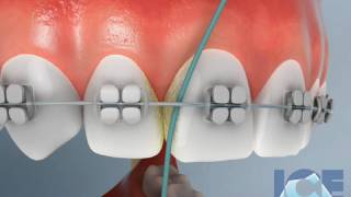 1 PROTOCOLO DE DESINFECCIÓN Y ESTERILIZACIÓN DE INSTRUMENTAL QUIRÚRGICO Y ODONTOLOGÍA [upl. by Brenda153]