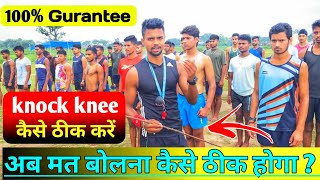 Knock knee kaise thik kare 😱 knock knee solution  knock knee best exercise  knock knee treatment [upl. by Bernadene828]