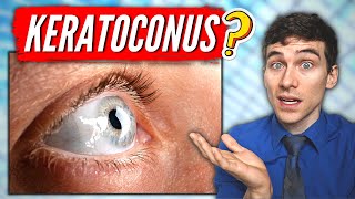 What is Keratoconus Keratoconus Eye Disease Explained [upl. by Stevena]