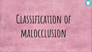 Angles Classification of Malocclusion  Easily Explained [upl. by Dijam]