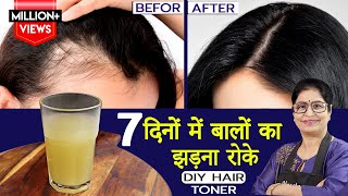 बालों का झड़ना जड़ से खत्म करें कितने भी खराब क्यों न हो नए बाल उगाये  Homemade Hair Growth Toner [upl. by Borries573]