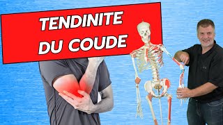 Douleurs au coude  tendinite tennis elbow ou épicondylite Traitements massages et exercices [upl. by Bowler]