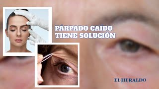 CódigoSalud  Párpado caído ¿Qué es en qué consiste la cirugía y cuánto cuesta [upl. by Bethesde]