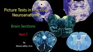 Picture Test in Neuroanatomy Brain Sections 7 [upl. by Meta]