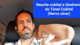 5 Dicas Tratamento da Neurite Cubital  Nervo Ulnar [upl. by Chryste]