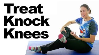 Treat Knock Knees with Easy Stretches amp Exercises [upl. by Komarek]