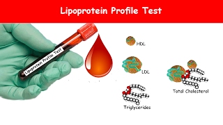 lipid profile calculation formula II LDL and VLDL formula [upl. by Ernst697]