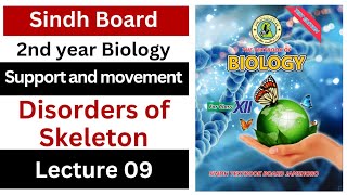 disorders of skeleton  support and movement  class 12 biology Sindh board New book [upl. by Ynnavoj882]